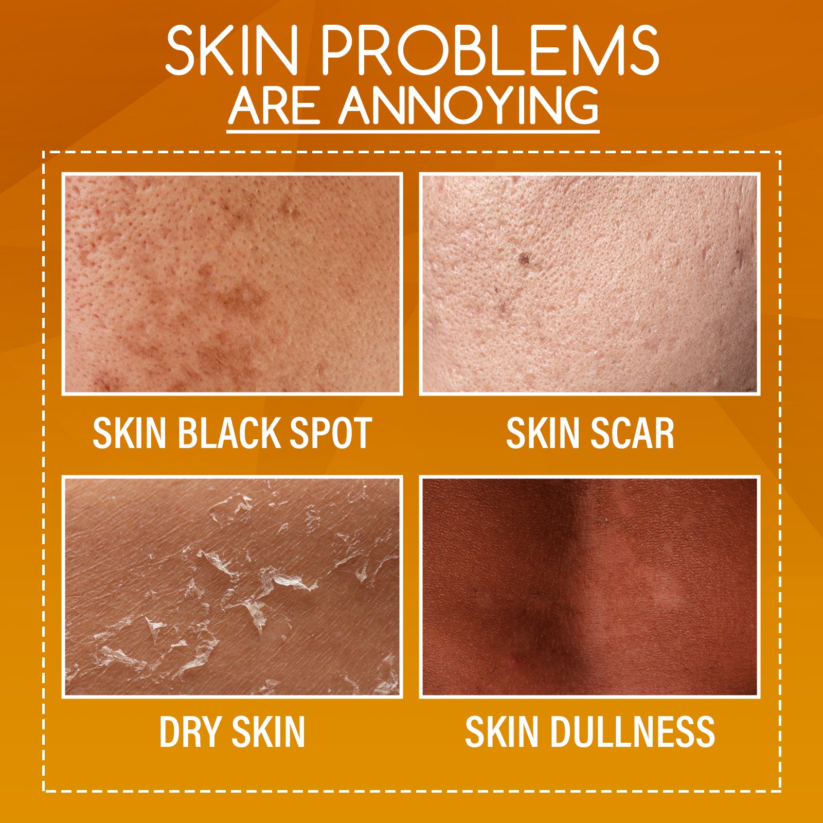 OUHOE Orange Peel Body Lotion, Exfoliation Lightening Dark Spots Brightening And Moisturizing Skin Treatment Lotion