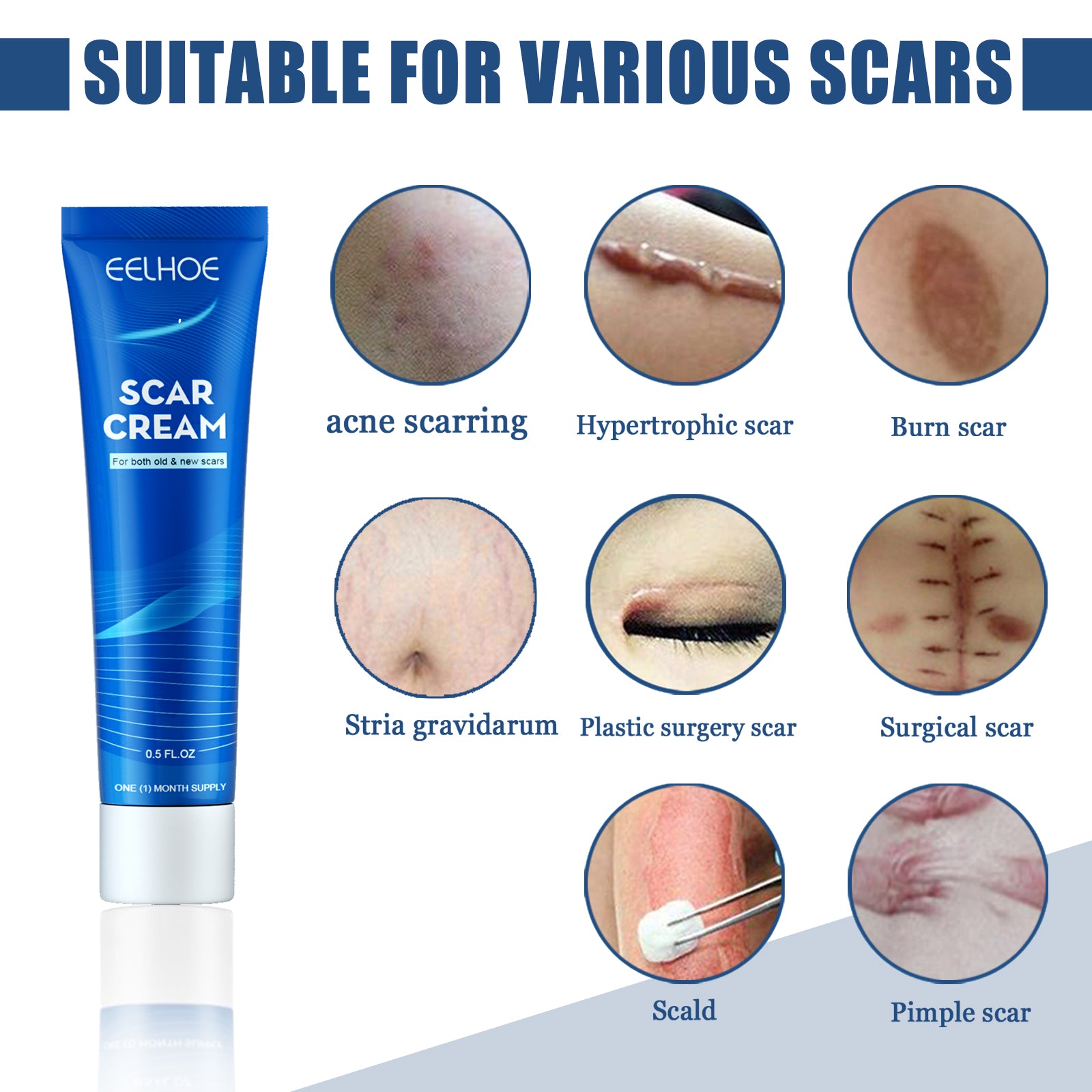EELHOE Skin Care Cream Gentle Care External Body Care Moisturizing Smooth Skin Care Cream